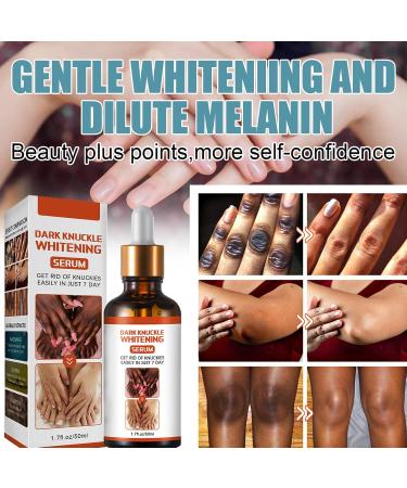 Dark Knuckle Whitening Serum Dark Knuckle Whitening Cream for Dark Knuckle Corrector Lighten Body Black Skin(50g) - Buy Online on GoSupps.com