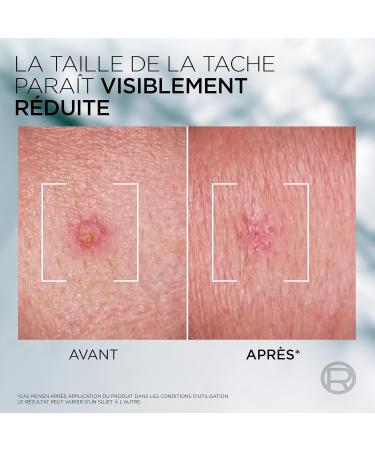 L'Or al Men Expert - P te S.O.S Anti-Imperfections - Soin Localis Anti-Boutons et Masque Purifiant - Enrichie en Niacinamide et Acide Glycolique - Derma Control - 45 ml - Buy Online on GoSupps.com