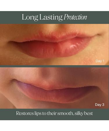 Doctor Rogers Lip Balm. Hydrating & Softening Lip Moisturizer for Very Dry Lips Natural & Hypoallergenic 0.15 Ounce (4.25 g) Tube 1 Count (Pack of 1) - Buy Online on GoSupps.com