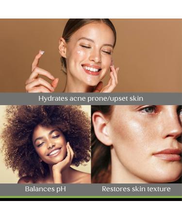 Light Moisture Creme | Natural Facial Moisturizer for Oily & Acne Prone Skin - 4 oz | International Shipping - Buy Online on GoSupps.com