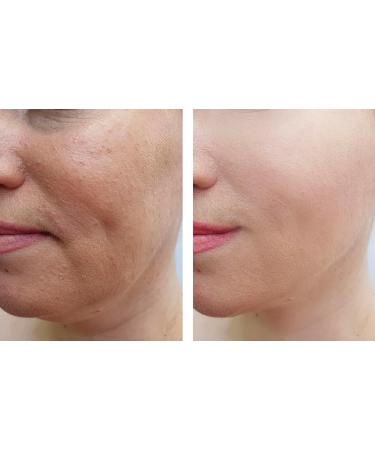 Vitality Precision Skin Retinol Pads 0.5% - 3 Month Supply for Youthful Skin | International Shipping Available - Buy Online on GoSupps.com
