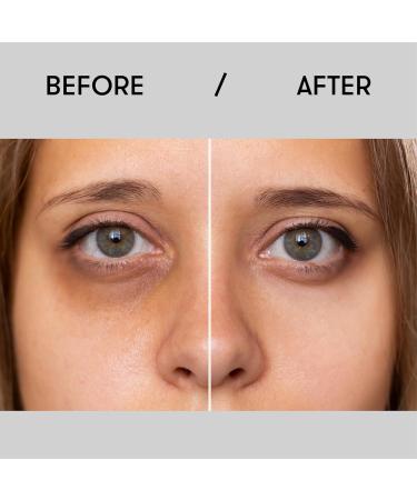 Sane Eye Cream for Dark Circles & Puffiness - Caffeine & Niacinamide Hydrating Treatment - 0.34 fl oz International Shipping - Buy Online on GoSupps.com