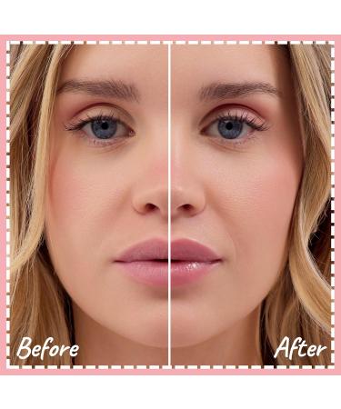 Crickle Daisy Lip Treat Balm - Hydrating & Nourishing Lip Balm with Avocado Olive and Coconut Oils - Softening Lip Moisturizer & Protection for Very Dry Lips - Sugar Blossom Scented 0.7oz - Buy Online on GoSupps.com