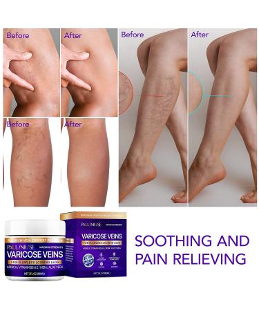 PALINRISE Varicose Vein Cream - 2 Oz | Improves Blood Circulation, Reduces Spider Veins & Heaviness - Buy Online on GoSupps.com