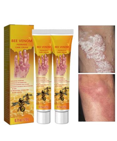 Cr me apaisante hydratante apaisante pour Le Psoriasis au Venin d'abeille de Nouvelle-Z lande 2pcs