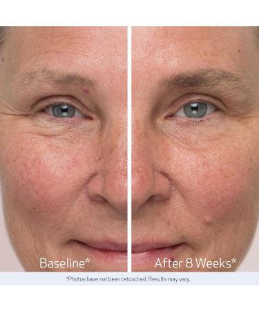 Obagi Nu-Cil Eyebrow Boosting Serum - Ultimate Eyebrow Growth Serum with Hyaluronic Acid - Dermatologist Approved for Thin Patchy & Over-Tweezed Eyebrows - Fast Absorbing - 6ml 2 Pack (6-Month supply) - Buy Online on GoSupps.com