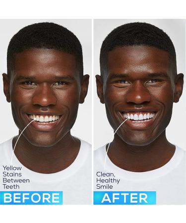 10 Pack GLO Brilliant Teeth Whitening Gel Kit | Fast, Pain-Free, Long Lasting Results | Clinically Proven | Includes 10 GLO Vials & 11 Piece Lip Care Set - Buy Online on GoSupps.com