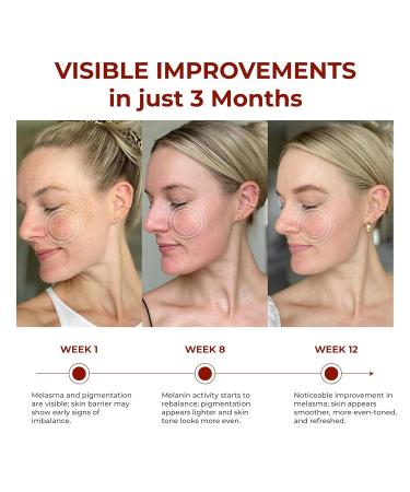 ABERA Saffron Serum For Melasma Treatment Renewing for Face Anti-Aging Treatment for Fine Lines & Wrinkles High Potency Saffron Extract Hydrating Serum Dark Spot Remover (2 BOXES) 1.01 Fl Oz (Pack of 2) - Buy Online on GoSupps.com