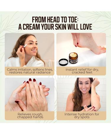 Grass-Fed Beef Tallow and Manuka Honey Balm Eczema Face & Body Cream Moisturizer for Dry Skin with Shea Butter Almond & Jojoba Oil Beeswax Arrowroot Vitamin E - Unscented - Made in Canada 2 oz - Buy Online on GoSupps.com