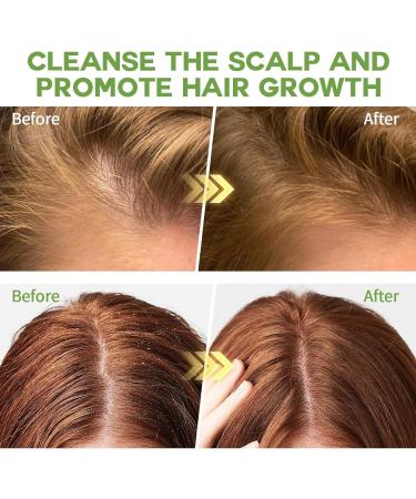Traitement Gommage Cuir Chevelu au Romarin et Menthe Rafra chissante & Huile de Romarin pour Cheveux & Brosse Massante - Cuir Chevelu Gras et Pelliculaire Soin Capillaire Doux pour des Cheveux Forts - Buy Online on GoSupps.com