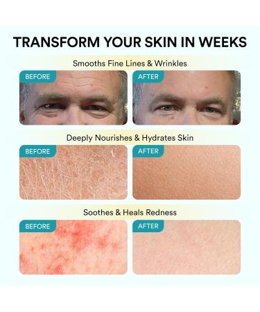 Cupids Tallow and Honey Balm Grass Fed Beef Tallow for Skin Face Moisturizer with Raw Manuka Honey Olive Oil Beeswax & Vitamin E - Buy Online on GoSupps.com