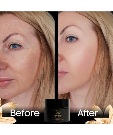 SC Sapphire Advanced Snail Mucin 92% Moisturizer | 90-Day Hydrating Cream for Dry Skin Blemishes & Fine Lines - International Shipping Available - Buy Online on GoSupps.com