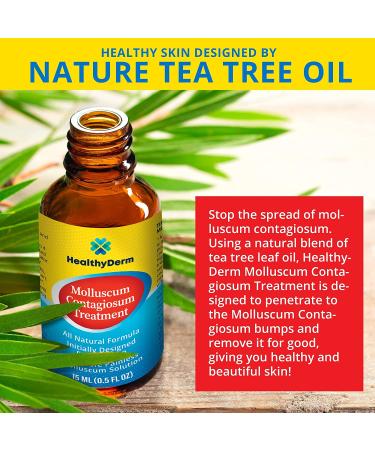 Molluscum Contagiosum Treatment - Fast, Safe, Painless All Natural Solution for Children and Adults - 15mL - 1 Month Supply - Buy Online on GoSupps.com