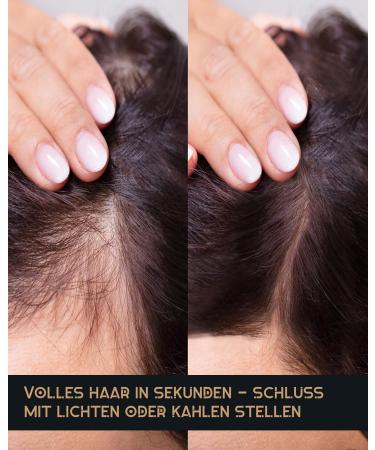 JP Confidence - Premium Hair Extensions | Full Hair in Seconds | Hair Thickening for Bald Spots (Light Brown) - Buy Online on GoSupps.com