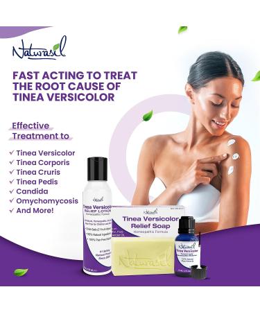 All Natural Tinea Versicolor Treatment Kit - Gentle Sulfur Lotion & Relief Soap - Fast & Effective for Discoloration  Itching  Irritation - Safe for All Skin Types & Ages - 4oz - Buy Online on GoSupps.com