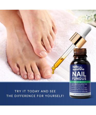 Toenail Fungus Treatment Extra Strength - Fast-Acting Nail Renewal Liquid for Damaged & Discolored Nails (1 FL OZ) - Shop Now for Effective Relief - Buy Online on GoSupps.com