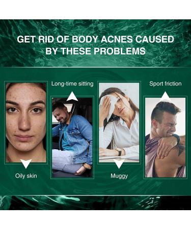 Acne Treatment Cream for Butt & Thigh - Removes Pimples, Ingrown Hairs - Spot & Cystic Acne Treatment - Moisturizes and Repairs Skin - Buy Online on GoSupps.com
