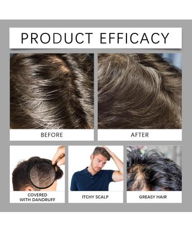  G n rique Shampoo and Conditioner Set for Men 473 ml Hydrating Hair Care Kit Soothing Scalp Relief Formula Root Repair & Nourishment (Refreshing & Moisturizing) for Dry Itchy Scalp - Buy Online on GoSupps.com