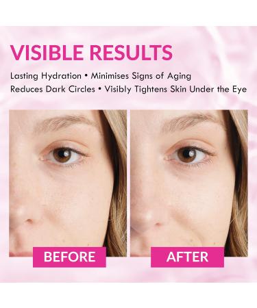 Wake Skincare Anti-Aging Eye Cream - ye Cream for Dark Circles and Puffy Eyes 30ml - Under Eye Cream - Eye Cream for Lines and Wrinkles and Dark Circle - Eye Cream for Men and Women - Buy Online on GoSupps.com