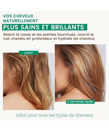 PHATOIL Huile de Jojoba Bio 118ML Organic Jojoba Oil 100% Naturelle Pure - Press e Froid - Sans Hexane - Huile Hydratante pour Peau Cheveux Corps Ongles Avec Pipette - Buy Online on GoSupps.com