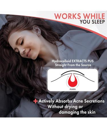 AX Acne Hydrocolloid Pimple Patch Bandage Variety Pack | Skincare Spot Treatment for Clearing Pores and Blemishes - Buy Online on GoSupps.com