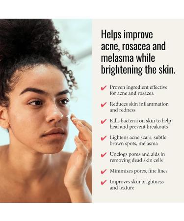 Azelaic Acid 14% Cream for Acne & Rosacea Relief - Reduce Inflammation & Minimize Pores - 1 Fl Oz - Buy Online on GoSupps.com