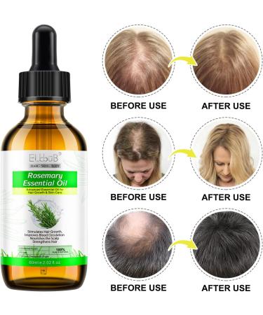 Rosemary Oil for Hair Growth & Skin Care -60ml 100% Pure Rosemary Essential Oil for Eyebrow and Eyelash Nourishes The Scalp Stimulates Hair Growth for Men Women - Buy Online on GoSupps.com