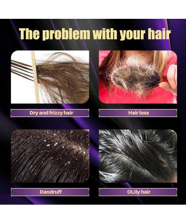  Kasmole Hair Loss Shampoo | Deep Cleansing Volumizing Shampoo for Hair Growth Hair Thickening Products Strengthening Shampoo for Regrowth Kasmole - Buy Online on GoSupps.com