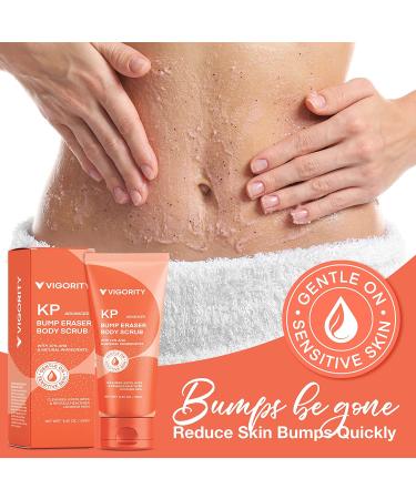 KP Bump Eraser Body Scrub - Exfoliating Strawberry Legs Treatment for Women & Men - 8.45oz - Buy Online on GoSupps.com