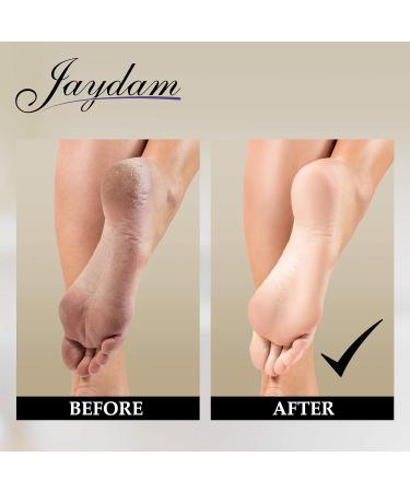 Jaydam 3 in 1 Natural Volcanic Pumice Stone Gift Set for Calluses, Warts, and Dry Skin Care - Foot Scrubber and Home Pedicure Tool - Buy Online on GoSupps.com