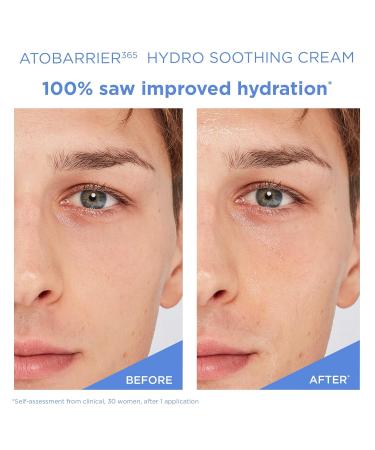 AESTURA ATOBARRIER365 Hydro Essence + Hydro Soothing Cream - Buy Online on GoSupps.com