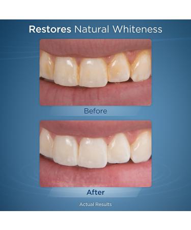 Waterpik Whitening Professional Water Flosser with Mint Flavour Teeth Whitening Tablets - Restores Natural Whiteness in 4 Weeks (WF-05UK) - Buy Online on GoSupps.com