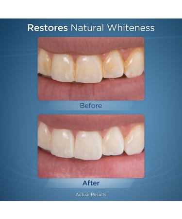 Waterpik Whitening Professional Waterflosser | Mint Tablets | Remove Plaque & Achieve Whiter Teeth in 2 Weeks (WF-05Eu) - International Shipping Available - Buy Online on GoSupps.com