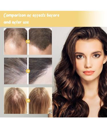 Batana Hair Oil moisturizes and repairs dry and frizzy hair smoothes and thickens hair growth and prevents hair loss and breakage (1) - Buy Online on GoSupps.com