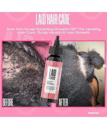 Anti-Itch Scalp Soothing Mega Growth Oil | Fast-Acting Relief & International Shipping - Buy Online on GoSupps.com