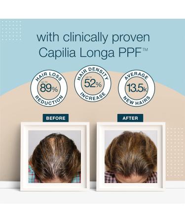 Stemgro Trichology Hair Regrowth Treatment for Men - Follicle Defence Foam 100ml - Hair Loss Treatment for Men with Thinning & Receding Hair - 97% Natural Regrowth Hair Care - Clinically Proven - Buy Online on GoSupps.com