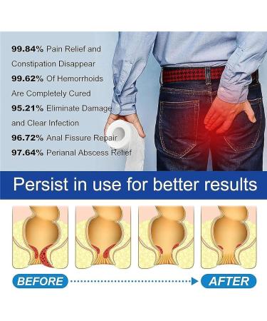 Natural Herbal Strength Hemorrhoid Capsules Hemorrhoid Relief Capsules Hemorrhoid Treatment Rapid Helps Relieve Itching Burning (3boxes) - Buy Online on GoSupps.com