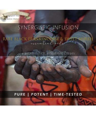 Frankincense & Sweet Myrrh Cream for Diabetic Foot Therapy | Nourishing Balm of Gilead for Skin Healing and Relief - Buy Online on GoSupps.com