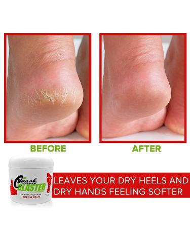 Crack Blaster Repair Balm - Intense Treatment for Dry Cracked Heels, Hands, Fingers, and Elbows - Fragrance-Free Skin Care - Buy Online on GoSupps.com