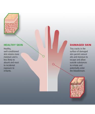 Buy GOJO HAND MEDIC Professional Skin Conditioner - Fragrance Free Travel Size (2 fl oz Pack of 12) for International Shipping - Buy Online on GoSupps.com