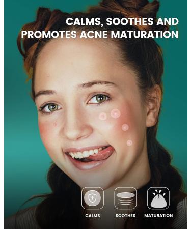 Jefusst Pimple Patch Set - 210 Hydrocolloid Acne Patches in 4 Sizes with Tea Tree & Calendula Oil - Vegan & Cruelty-Free - Buy Online on GoSupps.com
