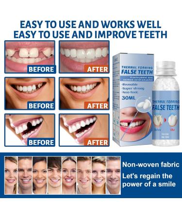 Brigtviee Temporary Tooth Repair Set - 60g Multifunctional Adhesive Beads for Missing Tooth Replacement & Veneers | International Shipping Available - Buy Online on GoSupps.com