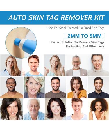 Skin Tag Remover Kit - Safe & Easy 2 in 1 Auto Removal Pen for Small to Large Skin Tags - Home Use - Blue - Buy Online on GoSupps.com