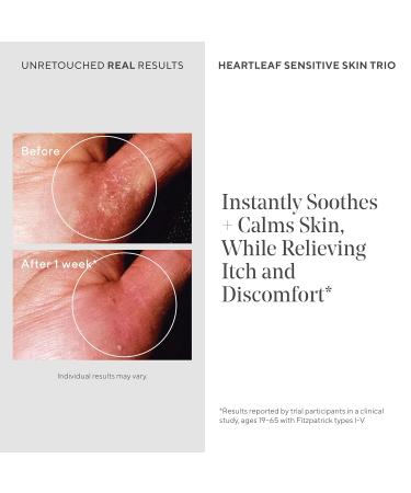 Murad Quick Relief Colloidal Oatmeal Treatment 5% Colloidal Oatmeal Cream with Ground Cherry & Oat Lipids for Eczema-Prone Skin Hydrates Soothes & Relieves Redness Itch Rashes 1.7 Fl Oz - Buy Online on GoSupps.com