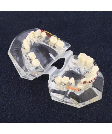 Orthodontic Model PVC Resin for Malocclusion Treatment - Adult & Child Dental Education Model with Wire Chain - Buy Online on GoSupps.com