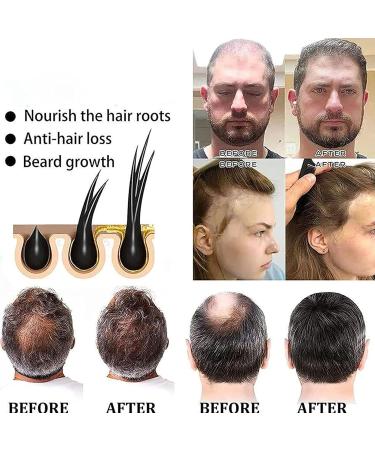  G n rique Hair Darkening Shampoo Bar | Ginseng Polygonum Multiflora Shampoo Polygonum Shampoo Bar Soap Hair Darkening Shampoo Bar Volumizing and Hydrating Soap - Buy Online on GoSupps.com