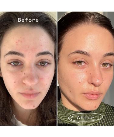 Pai Skincare - Organic Carbon Star Detoxifying Overnight Face Oil | Natural Vegan Sensitive Skincare (Travel 0.34 fl oz | 10 ml) 0.34 Fl Oz (Pack of 1) - Buy Online on GoSupps.com