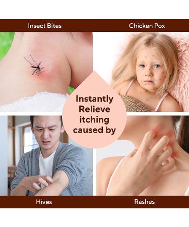 Marie Originals Itch Relief Soap Bar - Natural Relief from Insect Bites & Skin Irritations - Anti-Itch Calming Formula - 2.9 oz - Buy Online on GoSupps.com