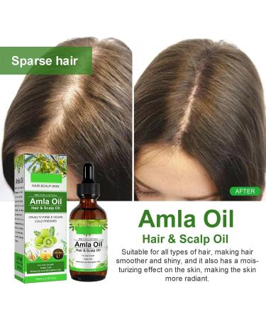 Amla Oil - Amla Hair Oil - Indian Amla Oil for Hair & Skincare - 100% Natural - Amla Oil for Natural Beautiful Long Soft & Strong Hair - Indian Hair Oil for Skin and Face (1) - Buy Online on GoSupps.com