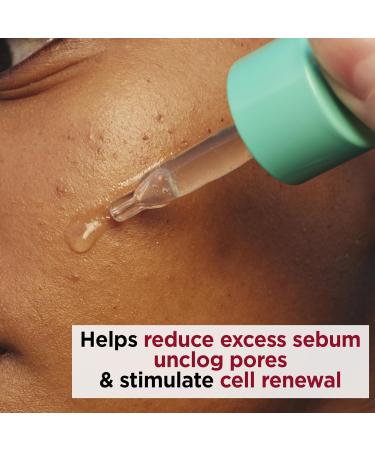 Clarins My Clarins PURE-RESET Resurfacing Blemish Serum 30ml - Buy Online on GoSupps.com